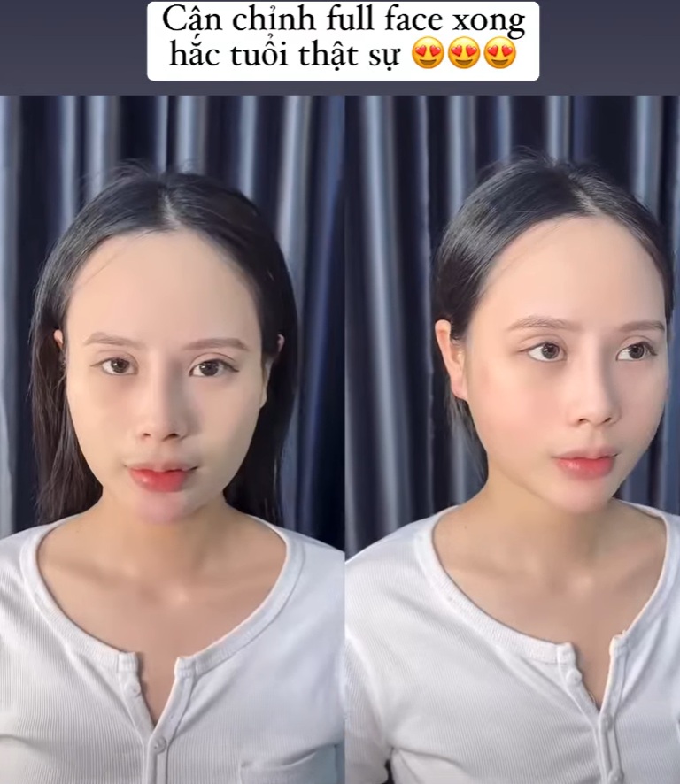 Căn chỉnh full face thay ngay vận số