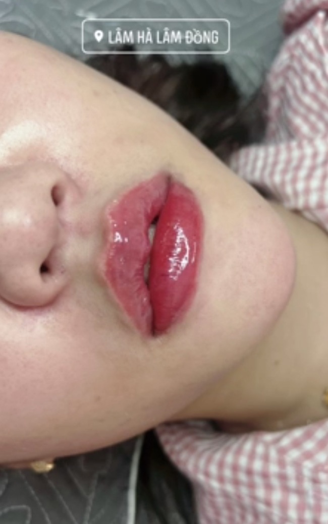 Môi Xinh khiến NYC chỉ tiếc hùi hụi vì ngày xưa không biết giữ